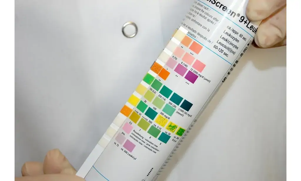 Stick urine strisce reattive