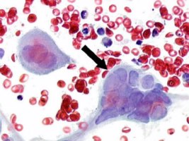 herpes virus microscopio