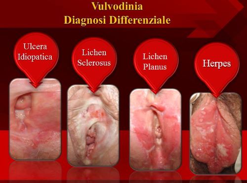 diagnosi differenziale500