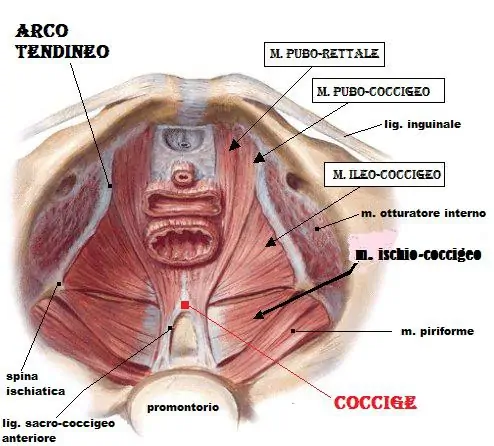 La contrattura (ipertono) del pavimento pelvico
